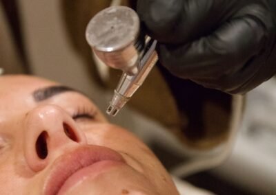 zuurstof-behandeling-skin-improvement-beauty