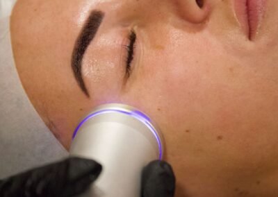 oxygen-power-facial-skin-improvement-beauty