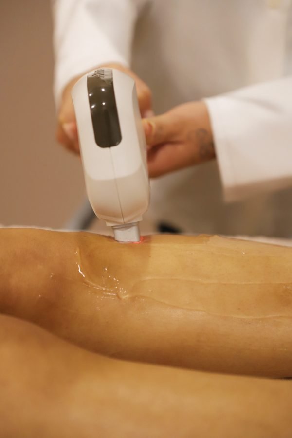 definitief ontharen laserbehandeling amsterdam 2