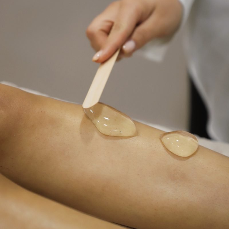 temp-sib definitief ontharen laserbehandeling amsterdam