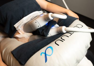 cyro-lipolyse-clatuu-skinimprovement-beauty-amsterdam