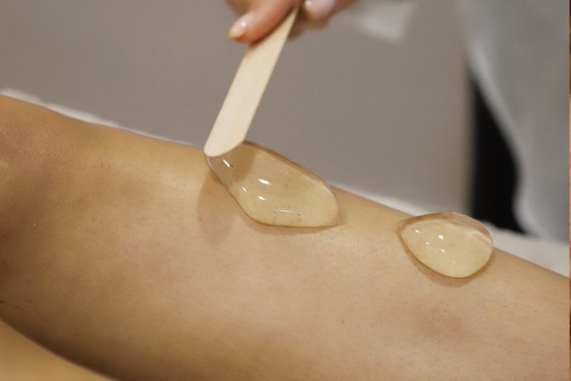 sib laser ontharen behandeling