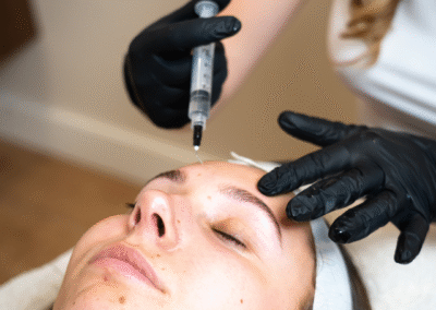 prx-skin-improvement-beauty-amsterdam