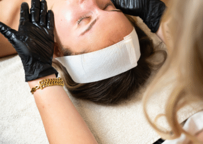 peeling-skin-improvement-beauty