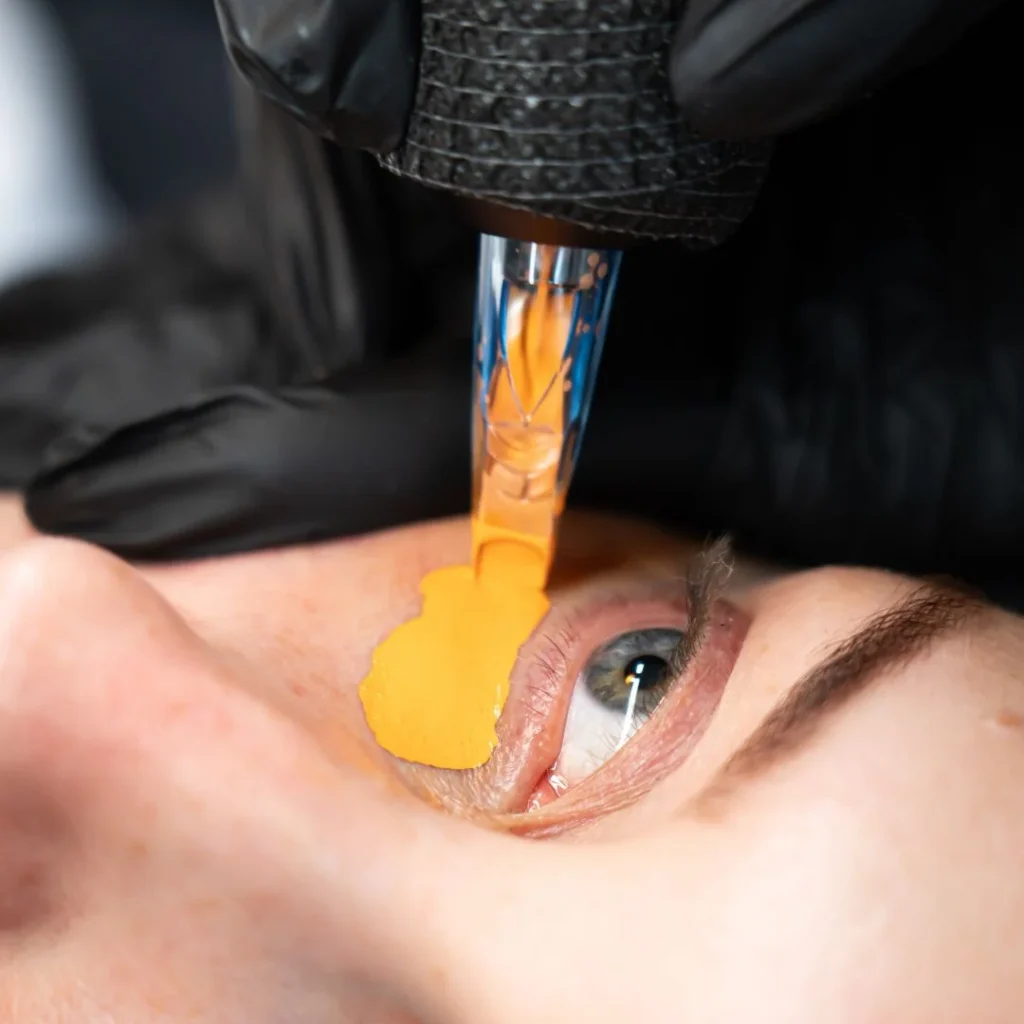 neutralisatie-donkere-kringen-skin-improvement-beauty