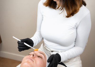 peeling-phformula-skin-improvement-beauty