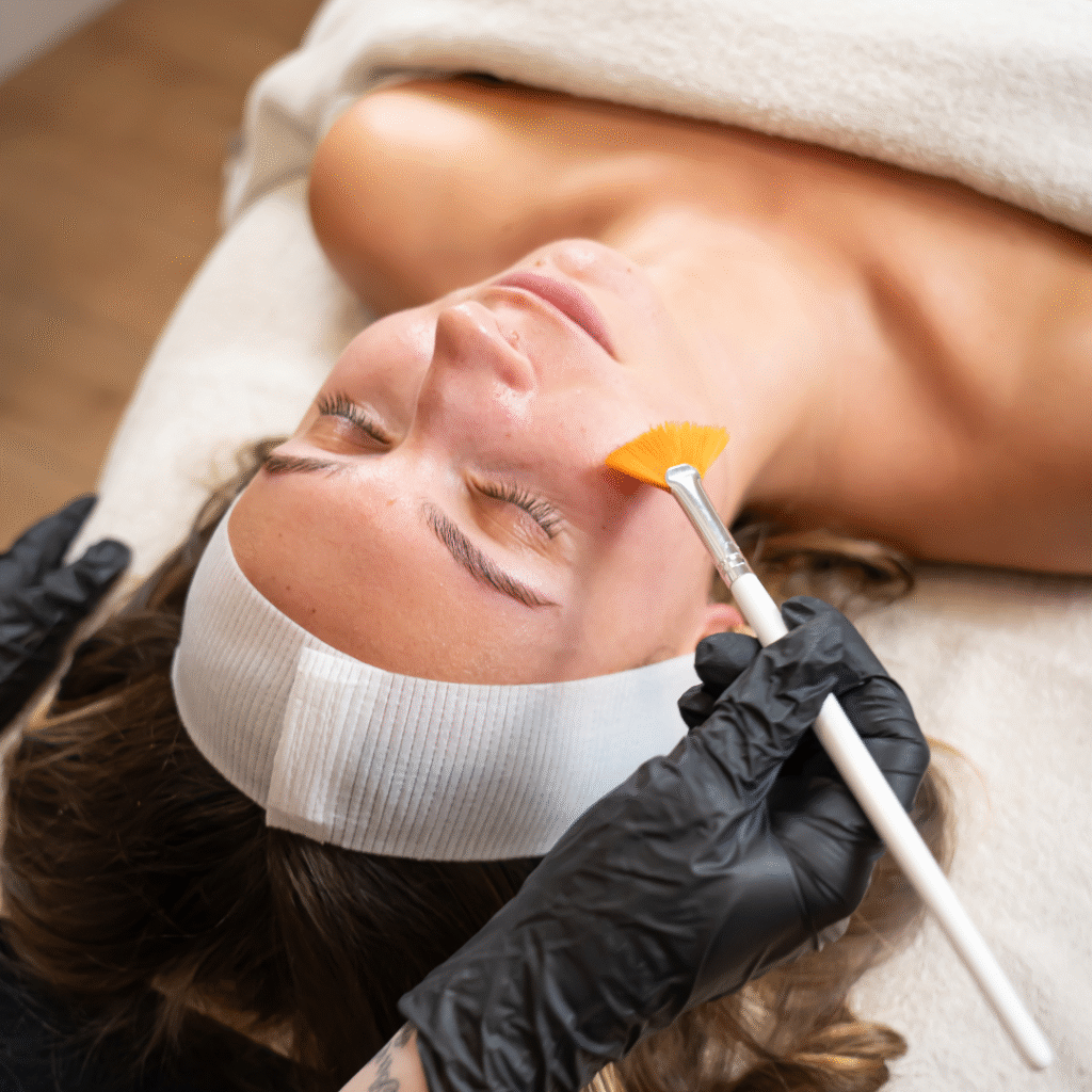 peeling-skin-improvement-beauty