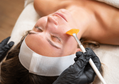 peeling-skin-improvement-beauty