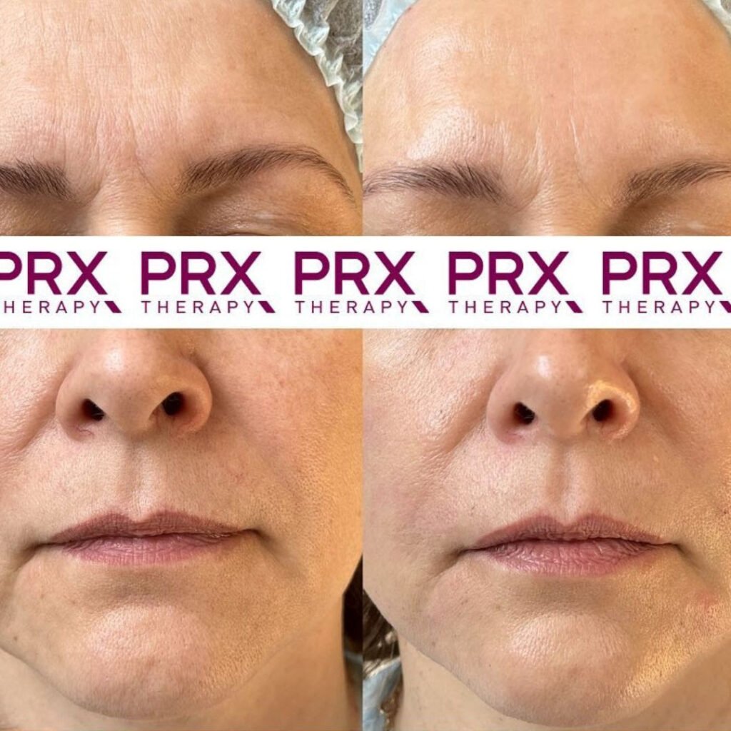 xr:d:daflgfkqiju:1457,j:9078529300911939222,t:23080112